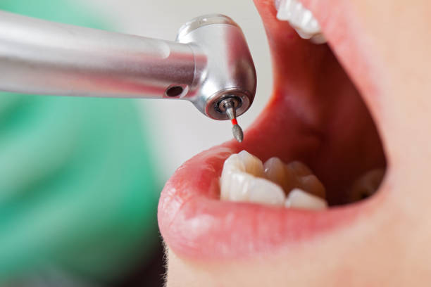 Best Emergency Dentist for Knocked-Out Tooth in Governors Clu, NC